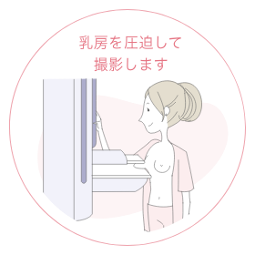 乳房を圧迫して撮影します