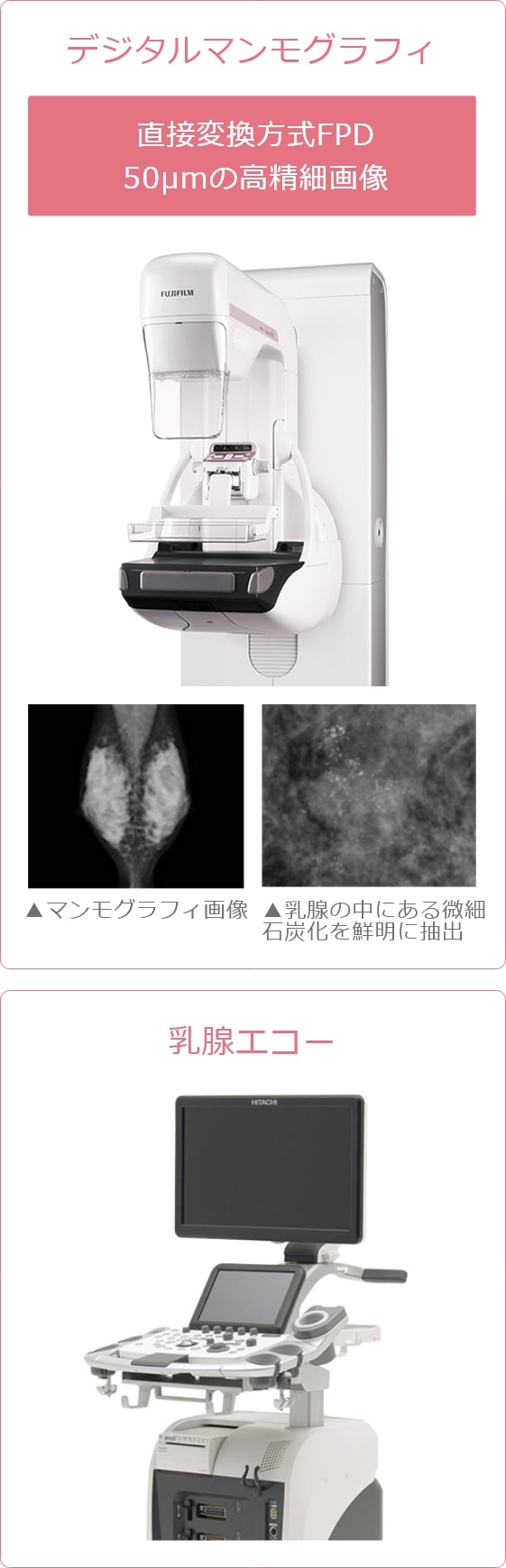 デジタルマンモグラフィ