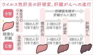 肝炎ウイルス検査