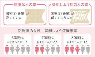 骨密度検査（エコー）